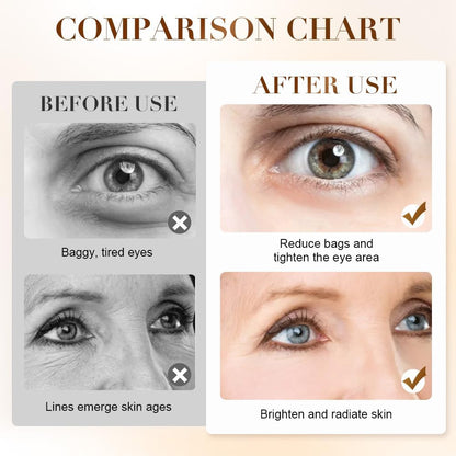 Snipva® HydraSteam Wand – Gentle Steam, Deep Eye Relief 🌱💧